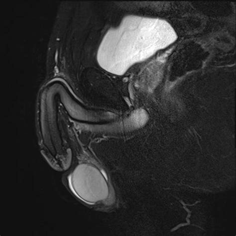 mri セックス|Experiment: MRT